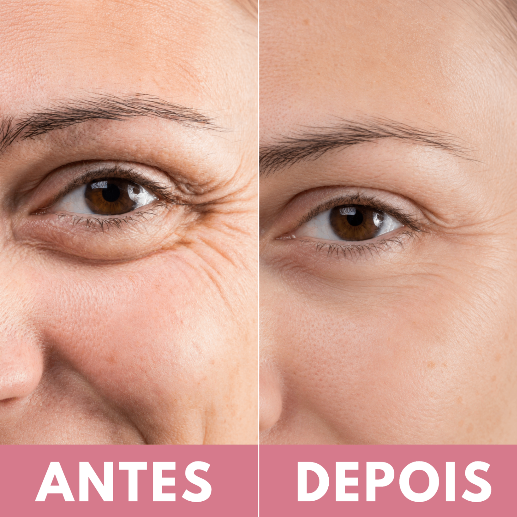 Comparação antes e depois 3