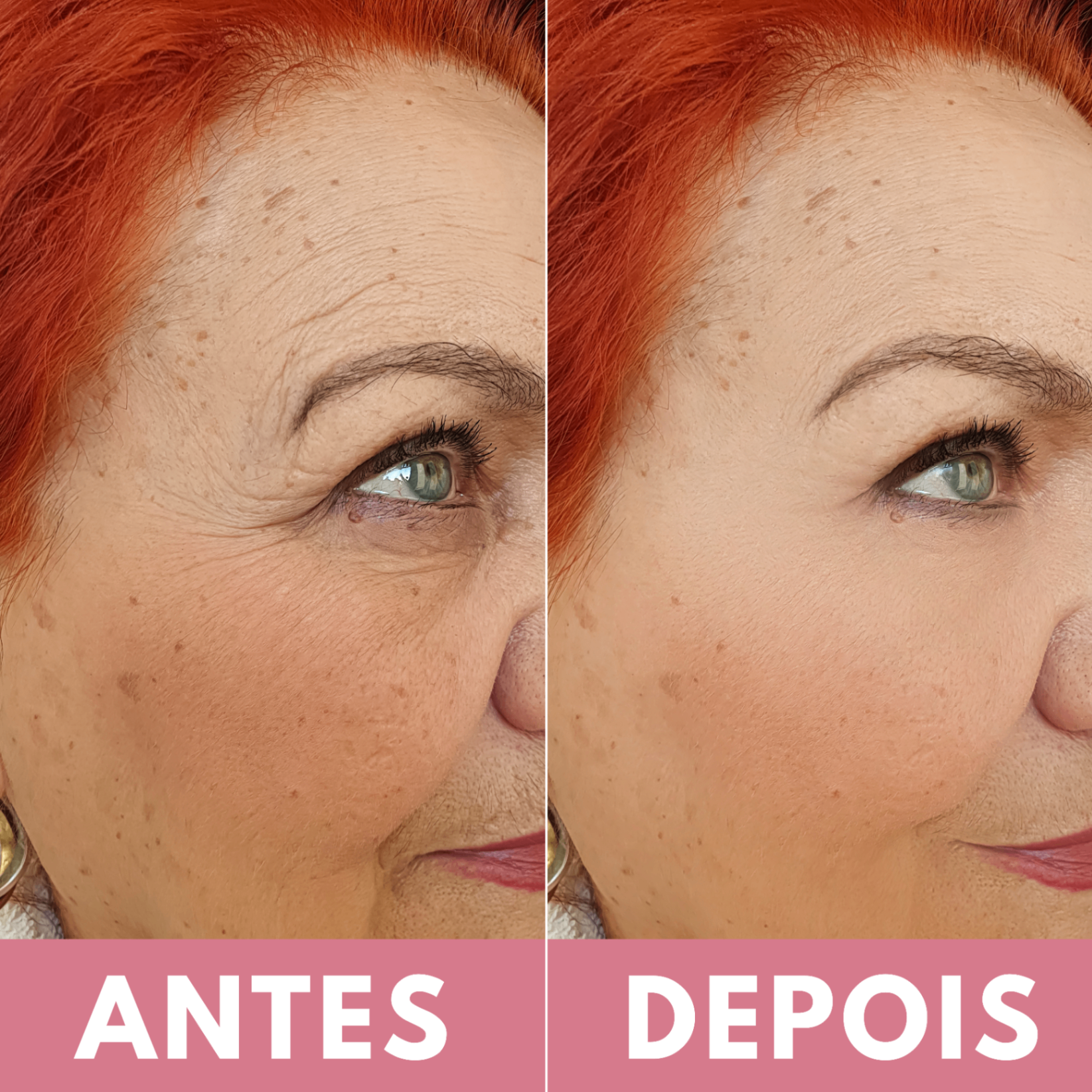 Comparação antes e depois 1